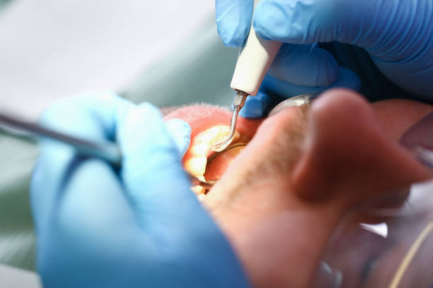Best Emergency Cosmetic Dentistry (e.g., broken veneers) in Pittsburg, KS