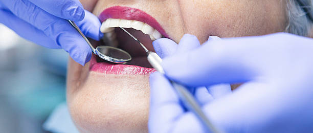 Best Emergency Wisdom Tooth Extraction in Pittsburg, KS