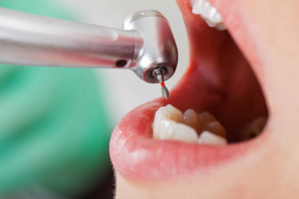 Best Emergency Treatment for Oral Infections in Pittsburg, KS